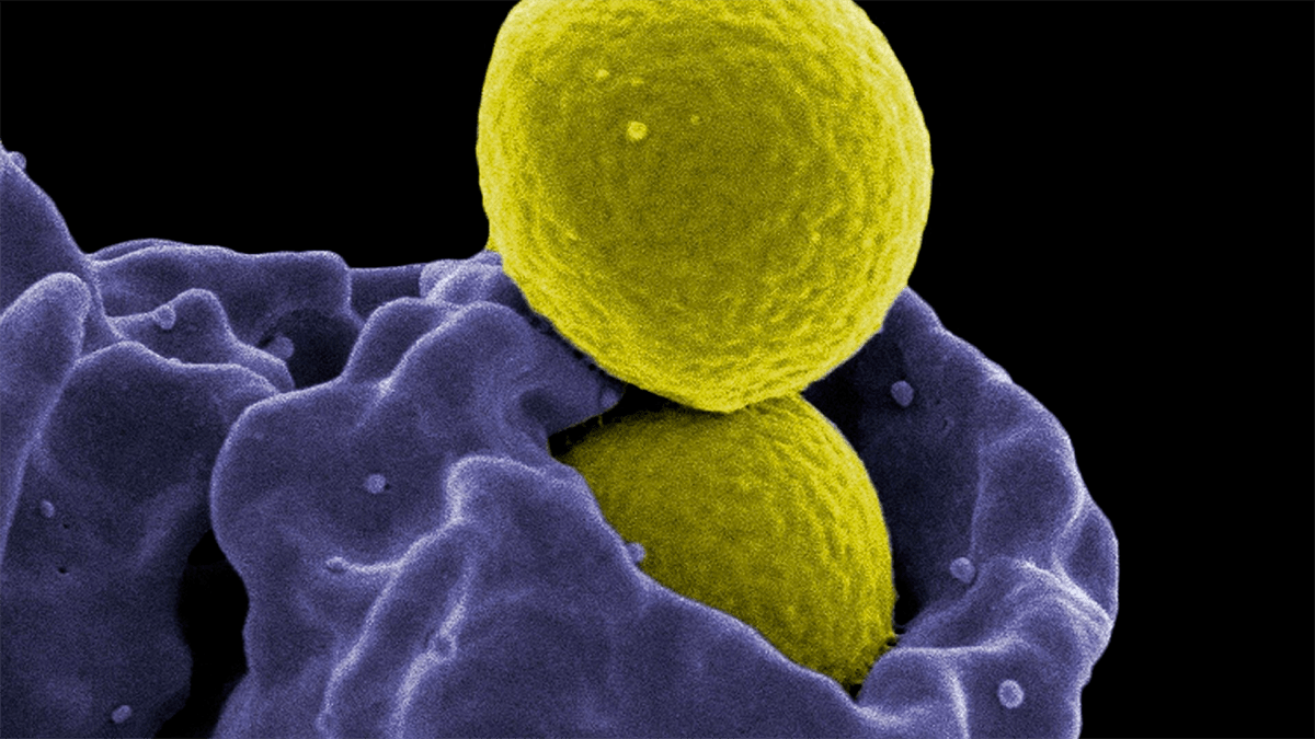 Бактерии staphylococcus aureus. Золотистый стафилококк MRSA. Prsa стафилококки.