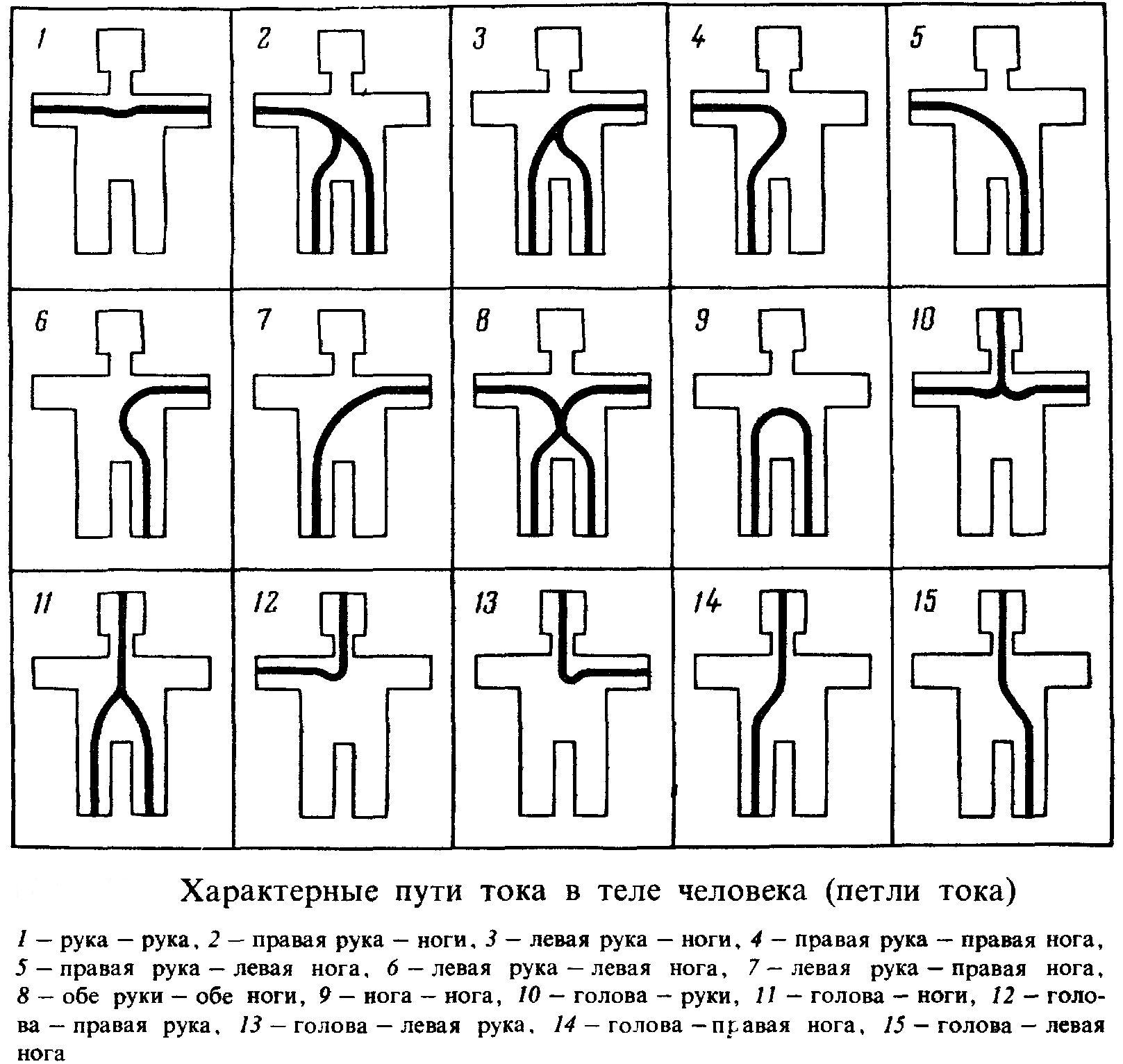 Схема поражения электрическим током. Пути прохождения электрического тока через тело человека. Пути протекания тока (петли тока). Путь прохождения тока при электротравме. Характерные пути прохождения тока в теле человека.